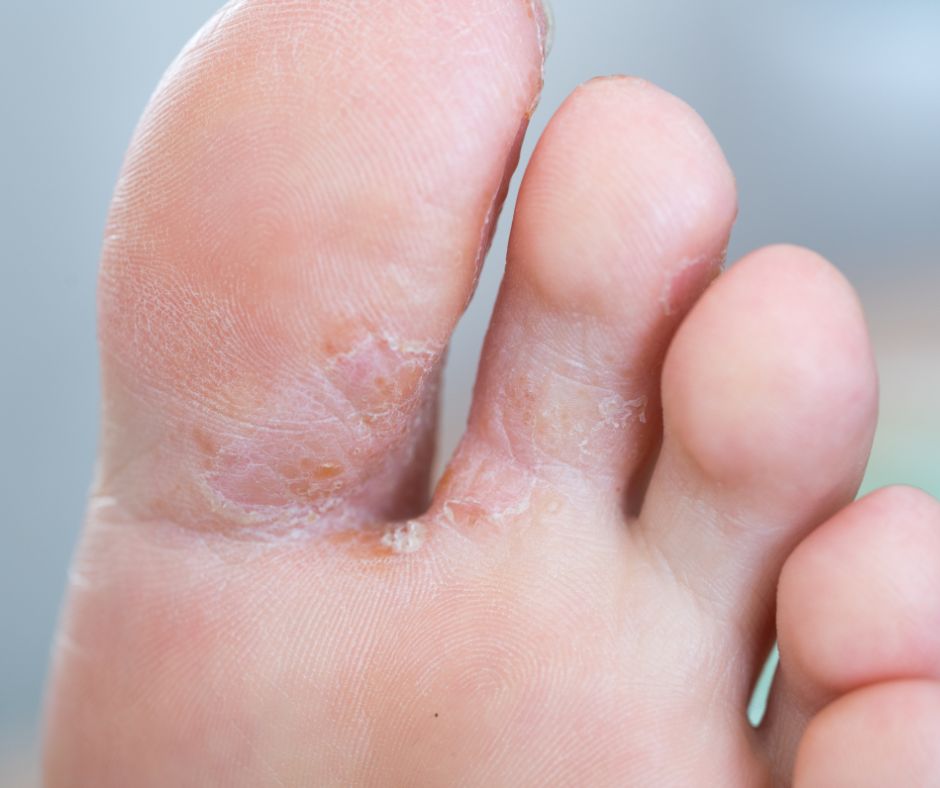 Antifungal Balm 50ml